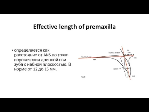 Effective length of premaxilla определяется как расстояние от ANS до точки пересечения