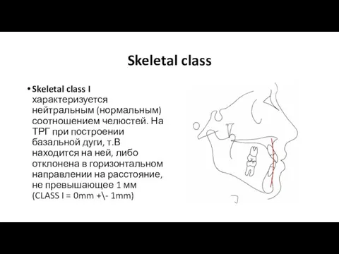 Skeletal class Skeletal class I характеризуется нейтральным (нормальным) соотношением челюстей. На ТРГ