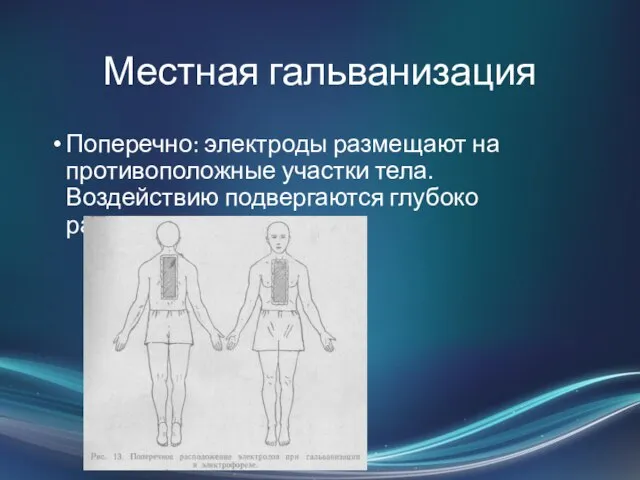 Поперечно: электроды размещают на противоположные участки тела. Воздействию подвергаются глубоко расположенные ткани. Местная гальванизация