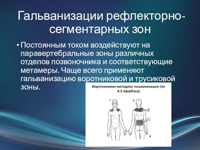 Гальванизации рефлекторно-сегментарных зон Постоянным током воздействуют на паравертебральные зоны различных отделов позвоночника