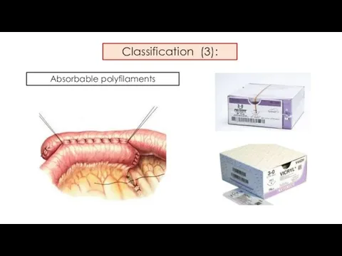 Classification (3): Absorbable polyfilaments