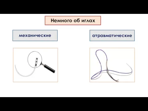 Немного об иглах механические атравматические