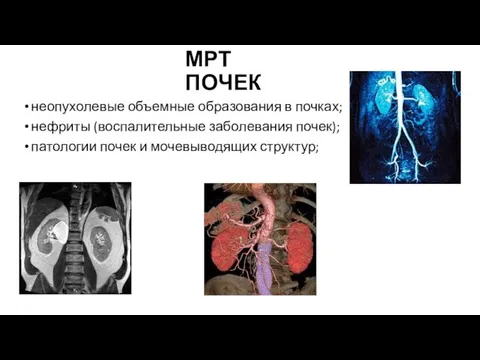 МРТ ПОЧЕК неопухолевые объемные образования в почках; нефриты (воспалительные заболевания почек); патологии почек и мочевыводящих структур;