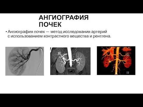 АНГИОГРАФИЯ ПОЧЕК Ангиография почек — метод исследования артерий с использованием контрастного вещества и рентгена.