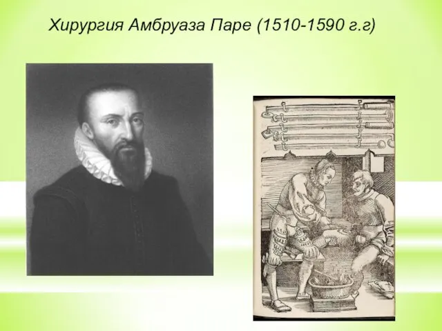 Хирургия Амбруаза Паре (1510-1590 г.г)