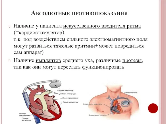 Абсолютные противопоказания Наличие у пациента искусственного вводителя ритма (=кардиостимулятор). т.к под воздействием