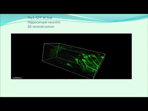 Thy1-GFP M-line Hippocampal neurons 3D reconstruction