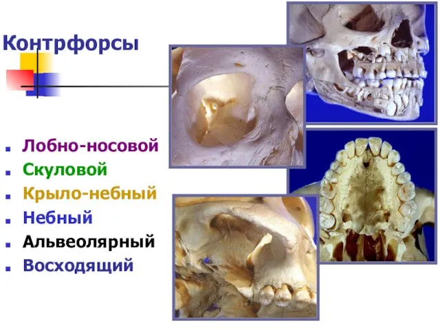 Контрфорсы Лобно-носовой Скуловой Крыло-небный Небный Альвеолярный Восходящий