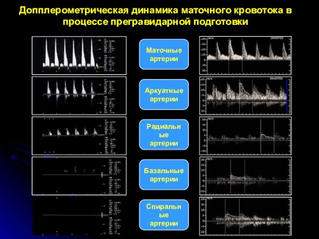 Маточные артерии Аркуатные артерии Радиальные артерии Базальные артерии Спиральные артерии Допплерометрическая динамика