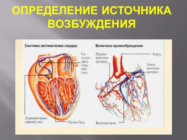 ОПРЕДЕЛЕНИЕ ИСТОЧНИКА ВОЗБУЖДЕНИЯ