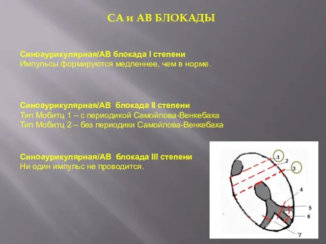 СА и АВ БЛОКАДЫ Синоаурикулярная/АВ блокада I степени Им­пульсы формируются медленнее, чем