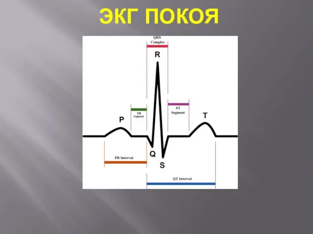 ЭКГ ПОКОЯ