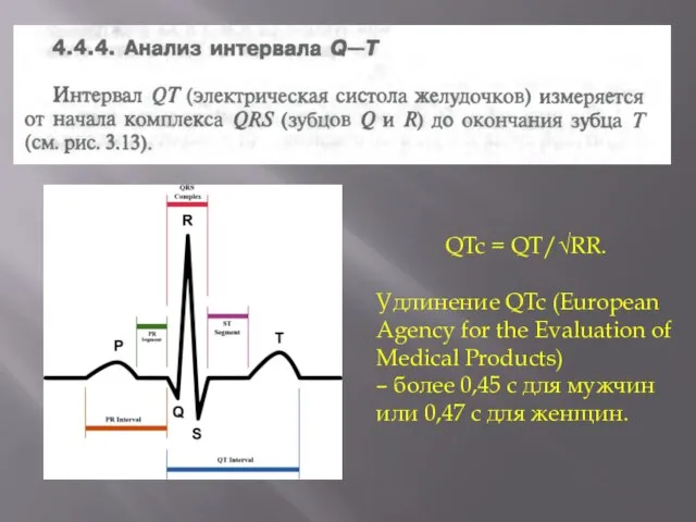 QTc = QT/√RR. Удлинение QTc (European Agency for the Evaluation of Medical