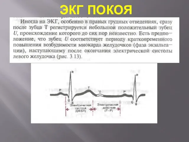 ЭКГ ПОКОЯ