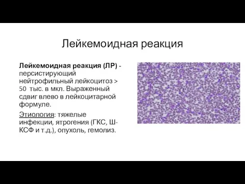 Лейкемоидная реакция Лейкемоидная реакция (ЛР) - персистирующий нейтрофильный лейкоцитоз > 50 тыс.