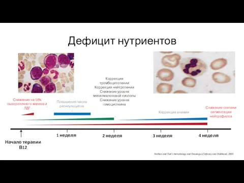 Дефицит нутриентов Nathan and Oski’s Hematology and Oncology of Infancy and Childhood, 2009.