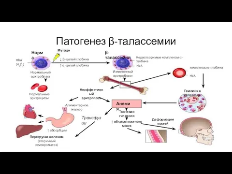 Патогенез β-талассемии