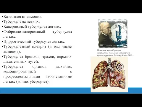 Казеозная пневмония. Туберкулема легких. Кавернозный туберкулез легких. Фиброзно-кавернозный туберкулез легких. Цирротический туберкулез