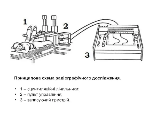 Принципова схема радіографічного дослідження. 1 – сцинтиляційні лічильники; 2 – пульт управління; 3 – записуючий пристрій.