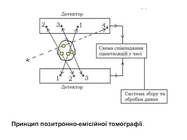 Принцип позитронно-емісійної томографії.