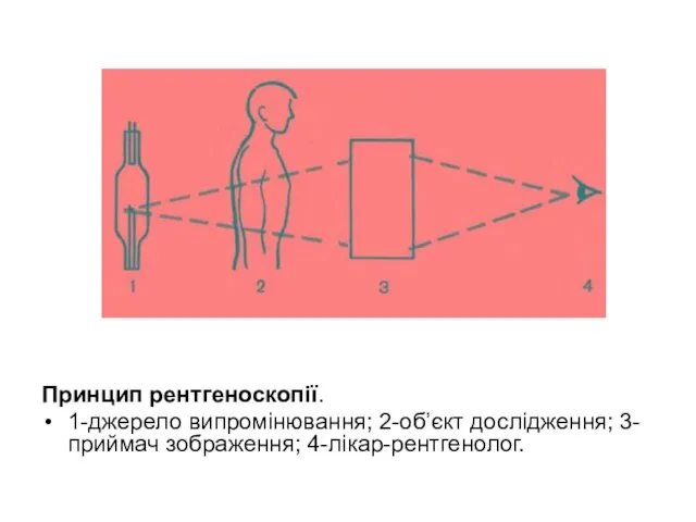 Принцип рентгеноскопії. 1-джерело випромінювання; 2-об’єкт дослідження; 3-приймач зображення; 4-лікар-рентгенолог.