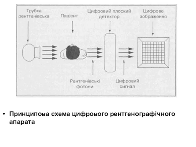 Принципова схема цифрового рентгенографічного апарата