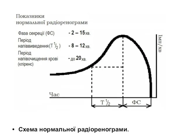 Схема нормальної радіоренограми.