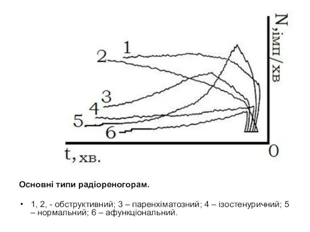 Основні типи радіореногорам. 1, 2, - обструктивний; 3 – паренхіматозний; 4 –