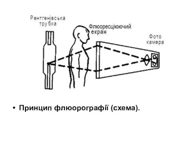 Принцип флюорографії (схема).