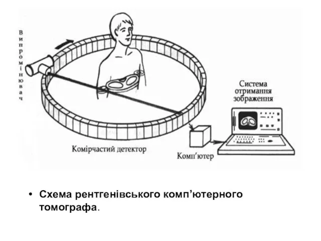 Схема рентгенівського комп’ютерного томографа.