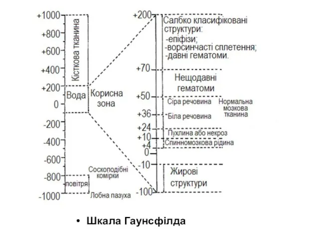 Шкала Гаунсфілда