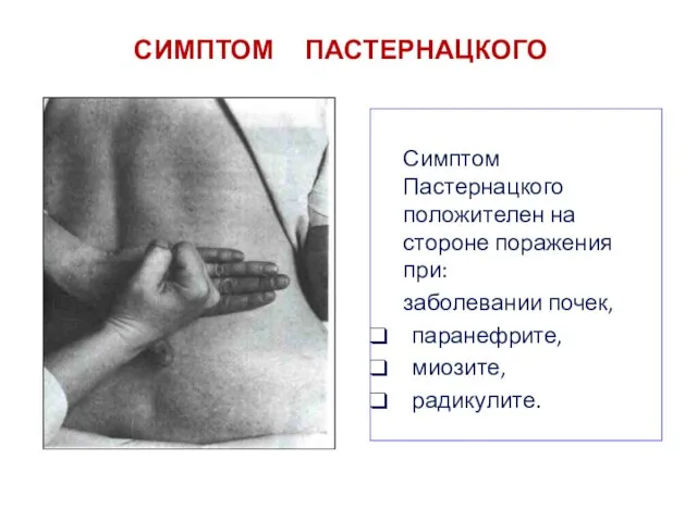 СИМПТОМ ПАСТЕРНАЦКОГО Симптом Пастернацкого положителен на стороне поражения при: заболевании почек, паранефрите, миозите, радикулите.