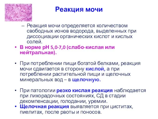 Реакция мочи Реакция мочи определяется количеством свободных ионов водорода, выделенных при диссоциации