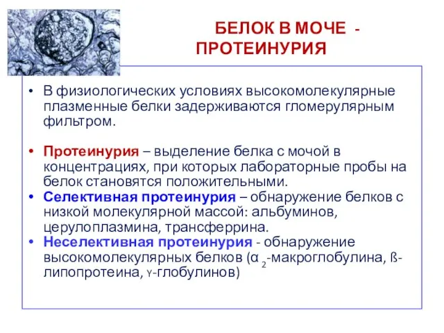 БЕЛОК В МОЧЕ - ПРОТЕИНУРИЯ В физиологических условиях высокомолекулярные плазменные белки задерживаются