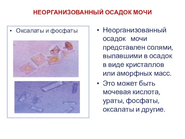 НЕОРГАНИЗОВАННЫЙ ОСАДОК МОЧИ Оксалаты и фосфаты Неорганизованный осадок мочи представлен солями, выпавшими