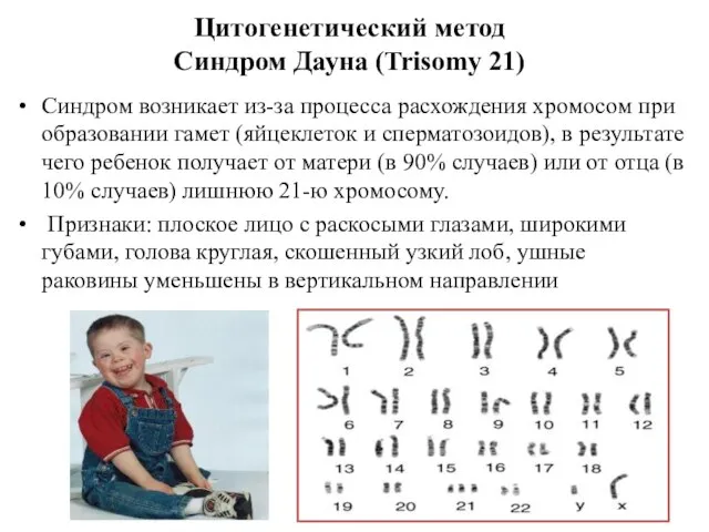 Цитогенетический метод Синдром Дауна (Trisomy 21) Синдром возникает из-за процесса расхождения хромосом