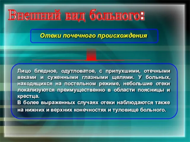 Внешний вид больного: Отеки почечного происхождения Лицо бледное, одутловатое, с припухшими, отечными