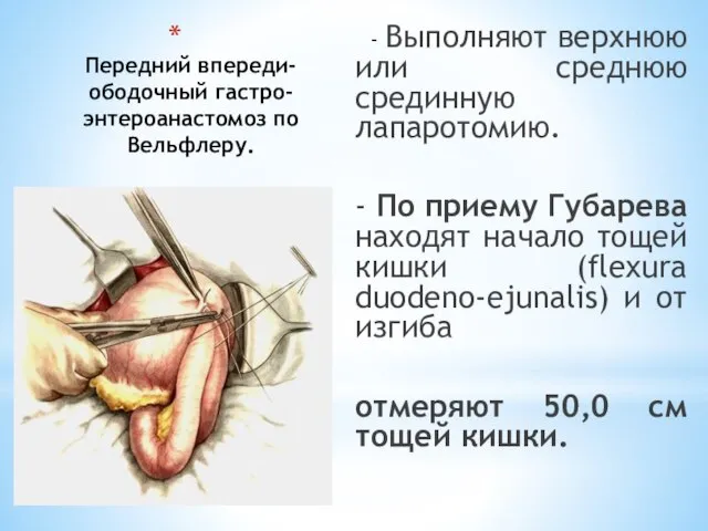 Передний впереди-ободочный гастро-энтероанастомоз по Вельфлеру. - Выполняют верхнюю или среднюю срединную лапаротомию.