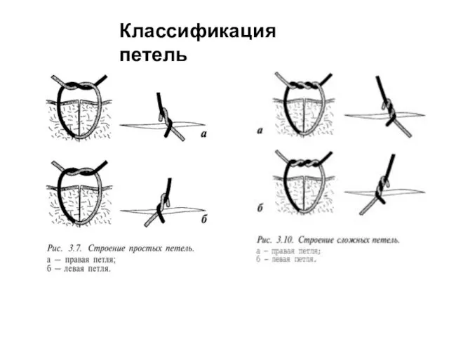 Классификация петель