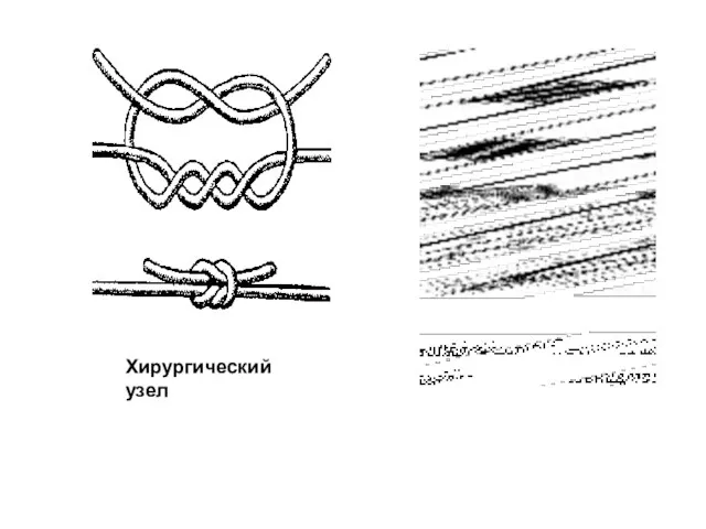 Хирургический узел