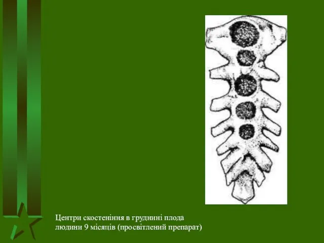 Центри скостеніння в груднині плода людини 9 місяців (просвітлений препарат)