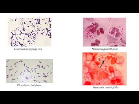 Listeria monocytogenes Clostridium botulinum Neisseria gonorrhoeae Neisseria meningitidis