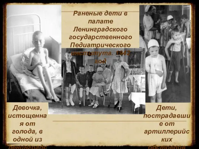 Девочка, истощенная от голода, в одной из ленинградских больниц. 1942г. Дети, пострадавшие