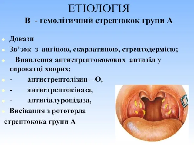 ЕТІОЛОГІЯ Β - гемолітичний стрептокок групи А Докази Зв’зок з ангіною, скарлатиною,