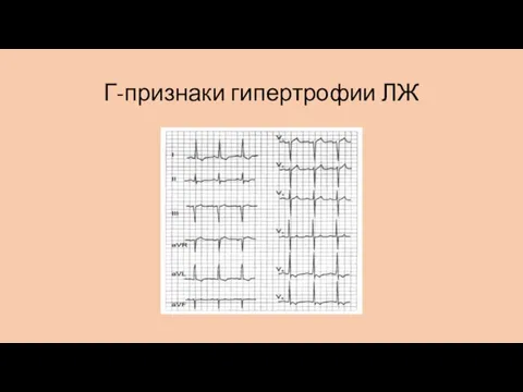 Г-признаки гипертрофии ЛЖ