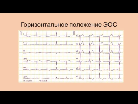 Горизонтальное положение ЭОС