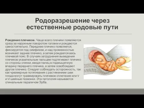 Родоразрешение через естественные родовые пути Рождение плечиков. Чаще всего плечики появляются сразу