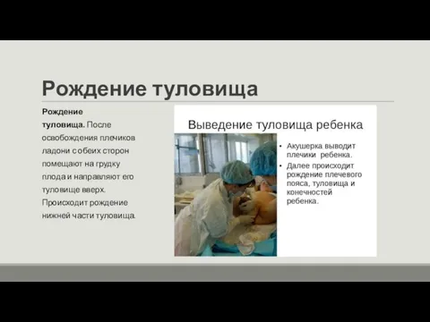 Рождение туловища Рождение туловища. После освобождения плечиков ладони с обеих сторон помещают