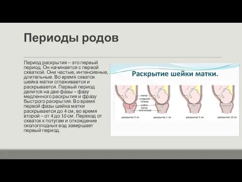 Периоды родов Период раскрытия – это первый период. Он начинается с первой