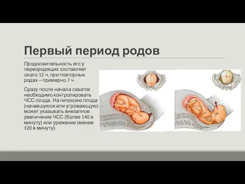 Первый период родов Продолжительность его у первородящих составляет около 12 ч, при